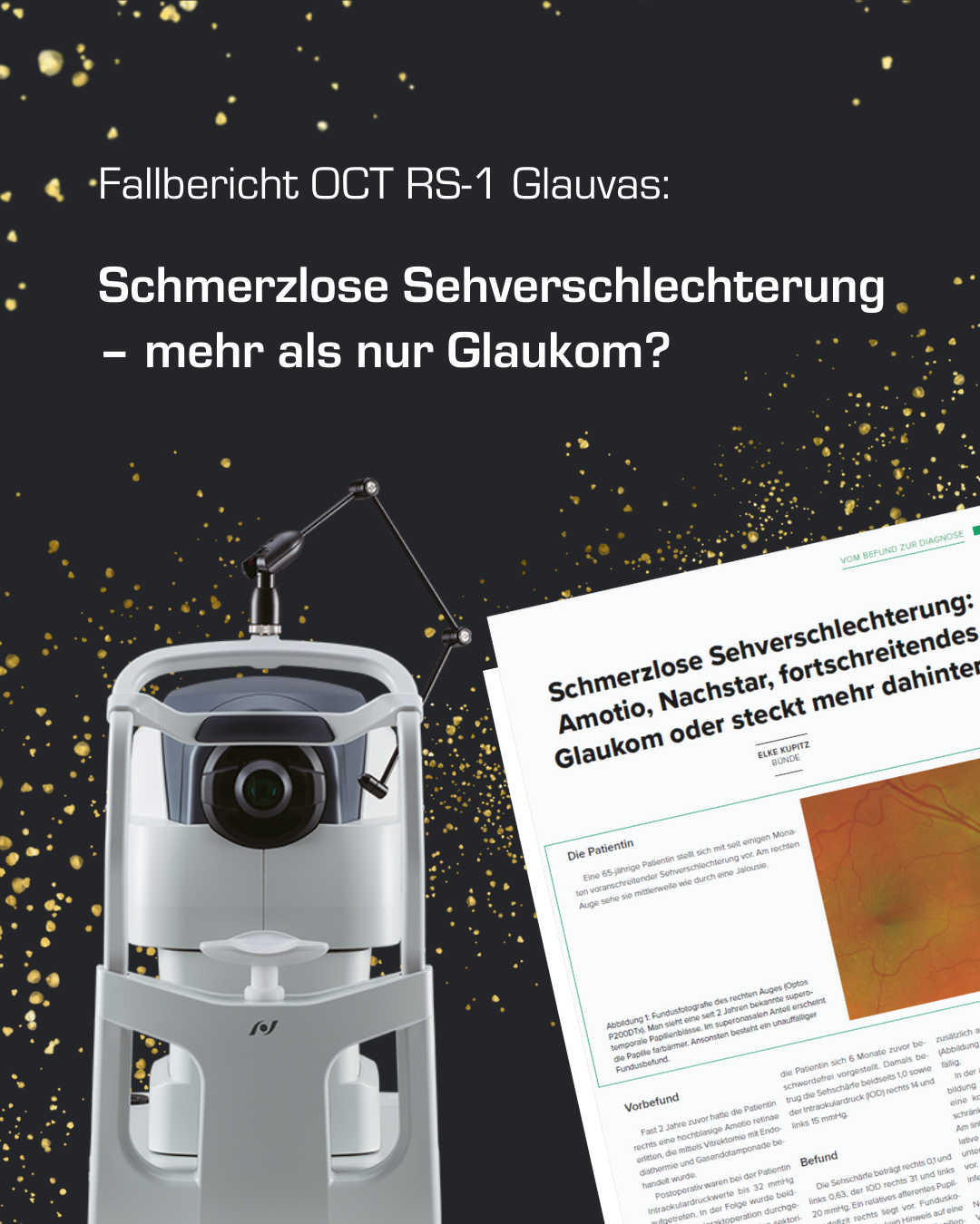 NIDEK OCT Fallstudie